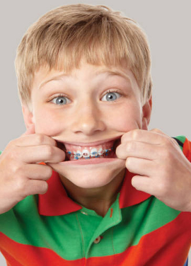 Aparate dentare in Timisoara